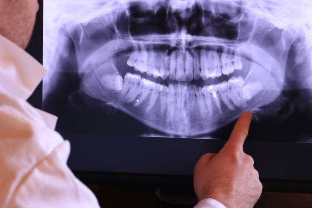 Best Broken or Cracked Tooth Emergency Dentist in Carnesville, GA
