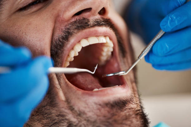 Best Broken or Cracked Tooth Emergency Dentist in Carnesville, GA